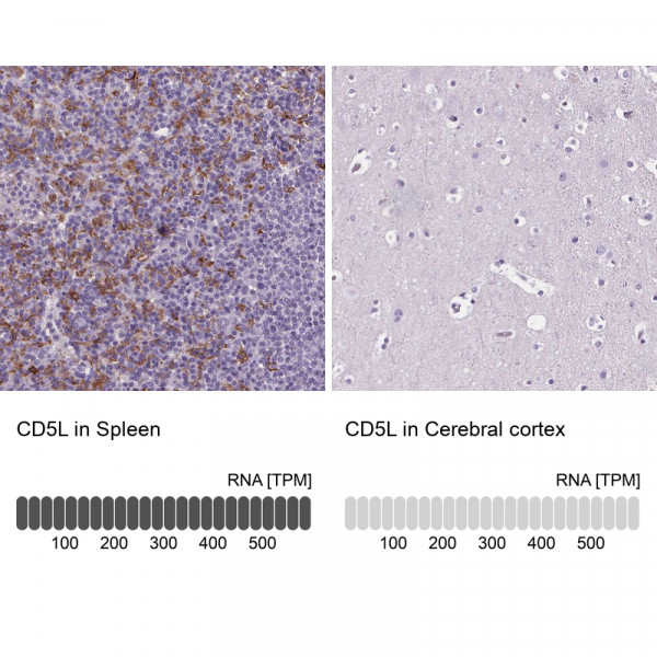 Anti-CD5L