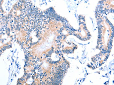 Anti-ACAD11