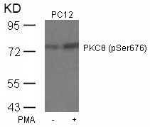 Anti-phospho-PKC theta (Ser676)