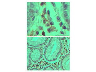 Anti-Caspase-3, clone 31A1067