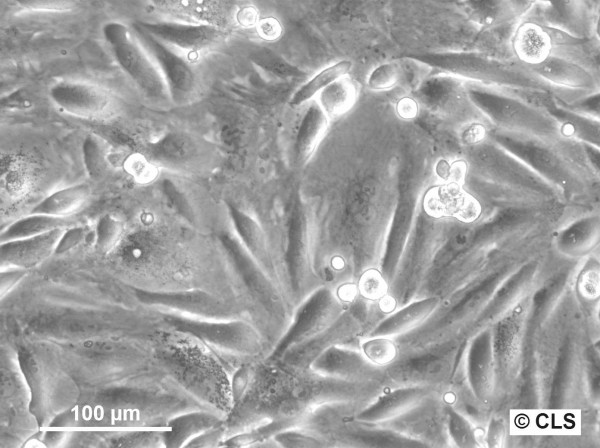 RCC-LR Cells