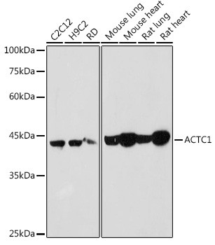 Anti-ACTC1