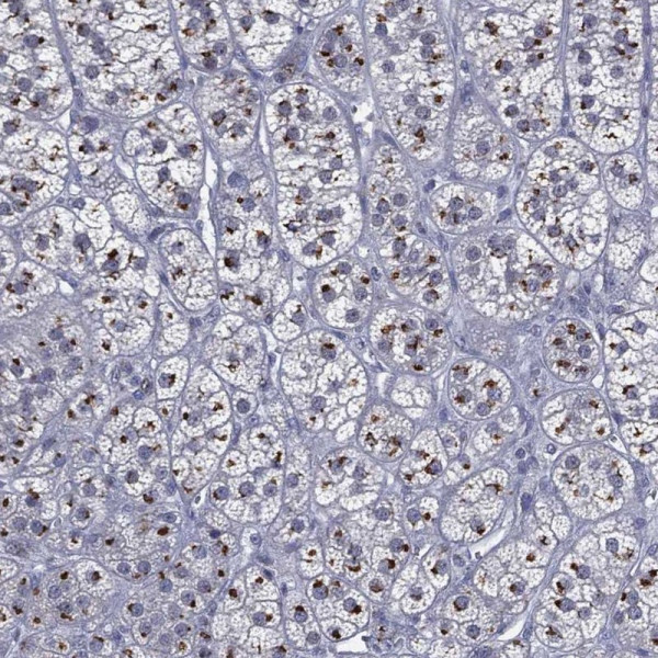 Anti-CASD1