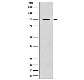 Anti-Amyloid beta / APP, clone BGC-1