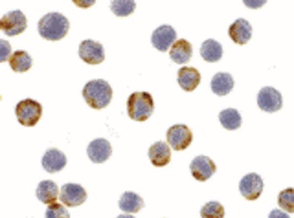 Anti-XBP1 (u form)