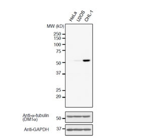 Anti-Detyrosinated Alpha Tubulin, clone RM444