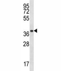 Anti-PSMA1