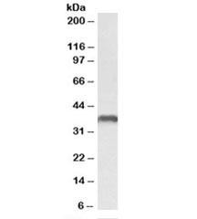 Anti-CLL-1