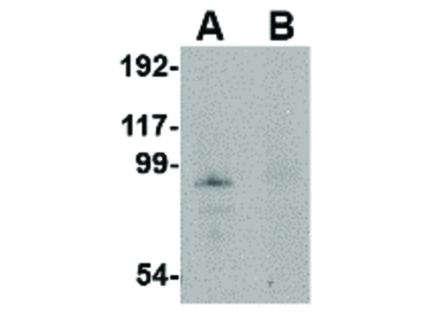 Anti-JPH4