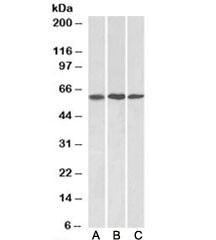 Anti-MMP14