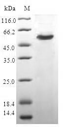 F-actin-capping protein subunit beta (CAPZB), human, recombinant
