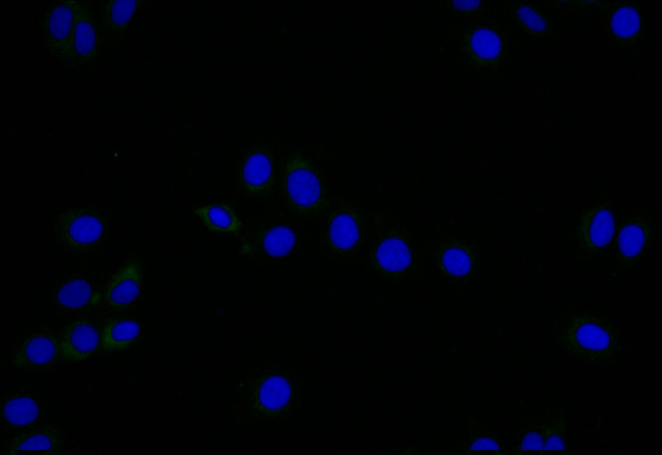 Anti-LYVE1 Recombinant Monoclonal, clone 11C11