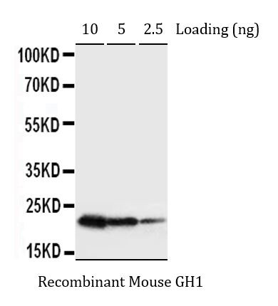 Anti-GH1 / Growth hormone