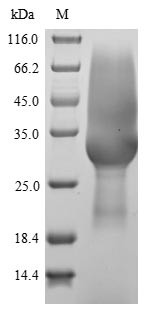 Sclerostin domain-containing protein 1 (Sostdc1), rat, recombinant