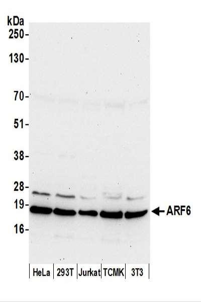Anti-ARF6/ADP Ribosylation Factor 6