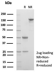 Anti-Alpha 1 microglobulin / AMBP / Bikunin, clone AMBP/4533