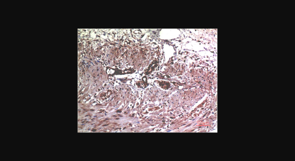 Anti-MMP2 (1H1), monoclonal