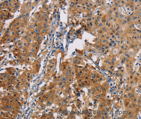 Anti-PDCD1LG2