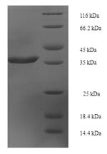 Rab-like protein 5 (RABL5), human, recombinant