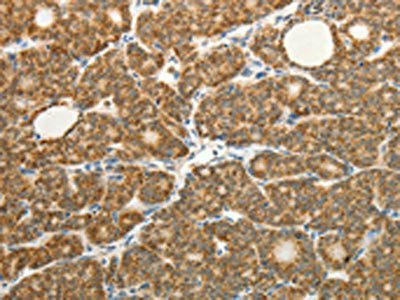 Anti-COL4A3