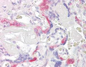 Anti-PHLDA2 / IPL, C-terminal