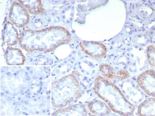 Anti-N-Cadherin / Cadherin-2 / CD325 (NCAD), recombinant antibody, clone rCDH2/8291