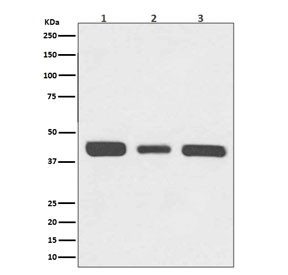 Anti-RPSA / 40S Ribosomal protein SA, clone AOAO-18