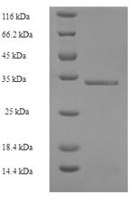 Ubiquitin D (UBD), human, recombinant
