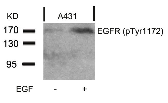 Anti-phospho-EGFR (Tyr1172)