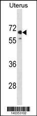 Anti-MMEL1, NT (MMEL1, MELL1, MMEL2, NEP2, Membrane metallo-endopeptidase-like 1, Membrane metallo-e