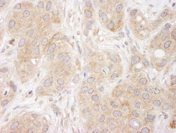 Anti-SNX1 (IHC)