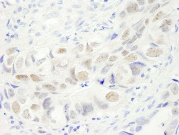 Anti-Anillin (IHC)