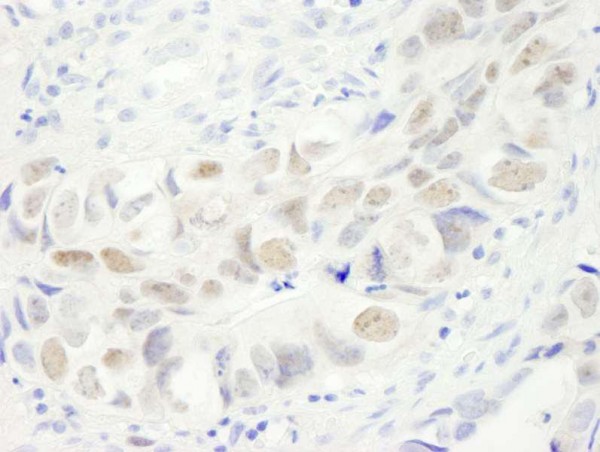 Anti-Anillin (IHC)