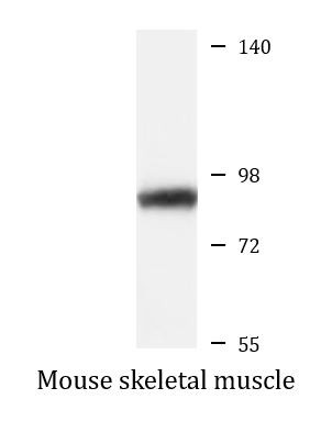 Anti-THOP1 / Thimet Oligopeptidase