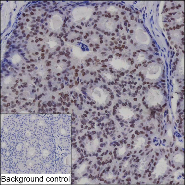 Anti-BMI1