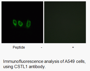 Anti-CSTL1
