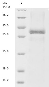 Low affinity immunoglobulin epsilon Fc receptor (FCER2), partial, human, recombinant