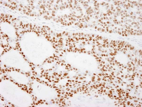 Anti-RCC2 (IHC)