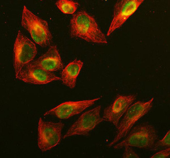 Anti-RAD51AP1 / RAD51-associated protein 1