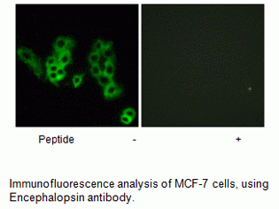 Anti-Encephalopsin
