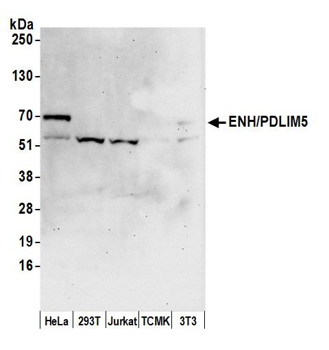 Anti-ENH/PDLIM5