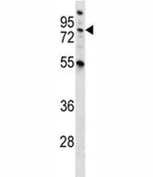 Anti-MST1 (Hepatocyte growth factor-like protein)