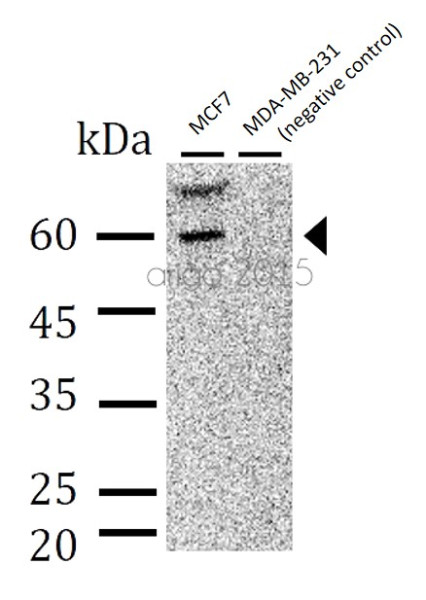 Anti-PPAR gamma