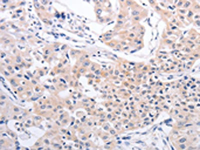 Anti-PFN4