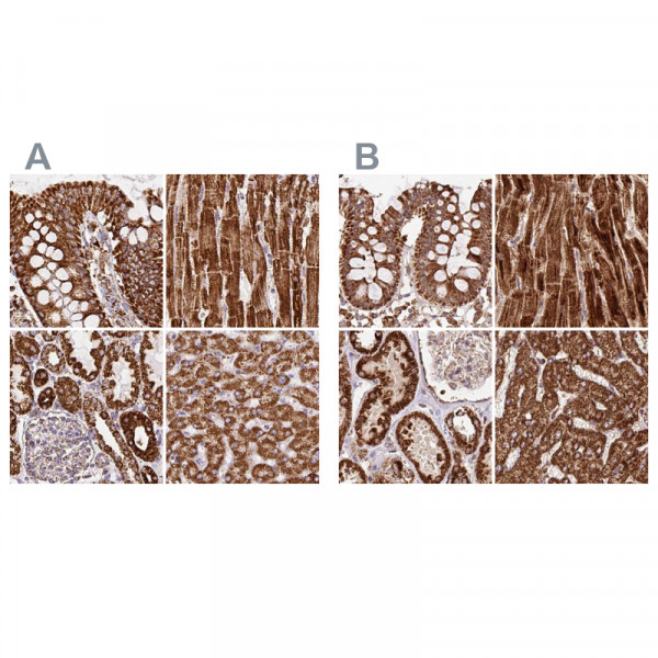 Anti-ATP5A1