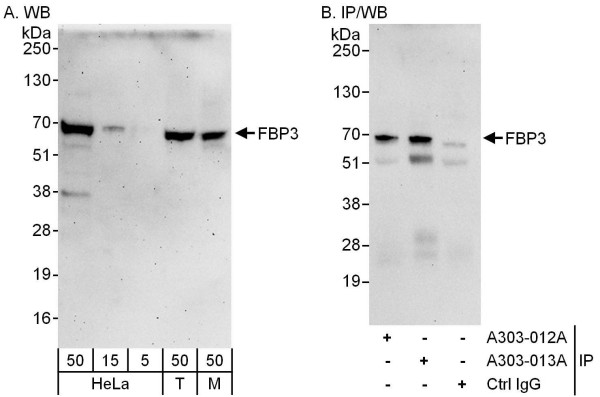 Anti-FBP3