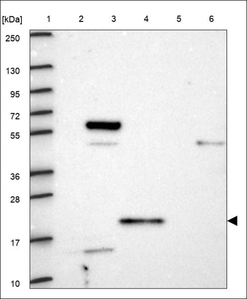 Anti-CST9L