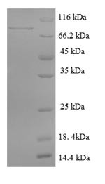 DENN domain-containing protein 1A (DENND1A), human, recombinant