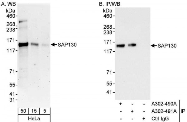 Anti-SAP130