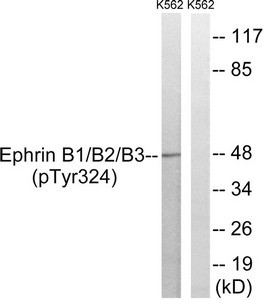 Anti-Phospho-EFNB1/EFNB2/EFNB3 (Tyr324)
